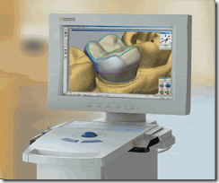 כתר חרסינה מלאה CEREC