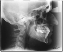 digital cephalometric צילום צפלומטרי