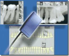 digital dental xray צילום שיניים